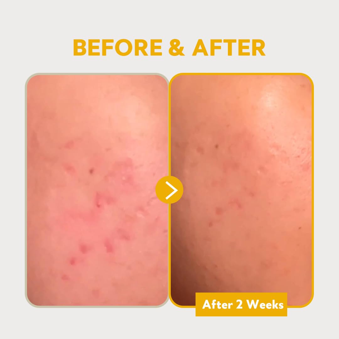 TIRTIR Pure Vitamin C 24% Serum 30ml + Collagen Lifting Eye Cream 15ml