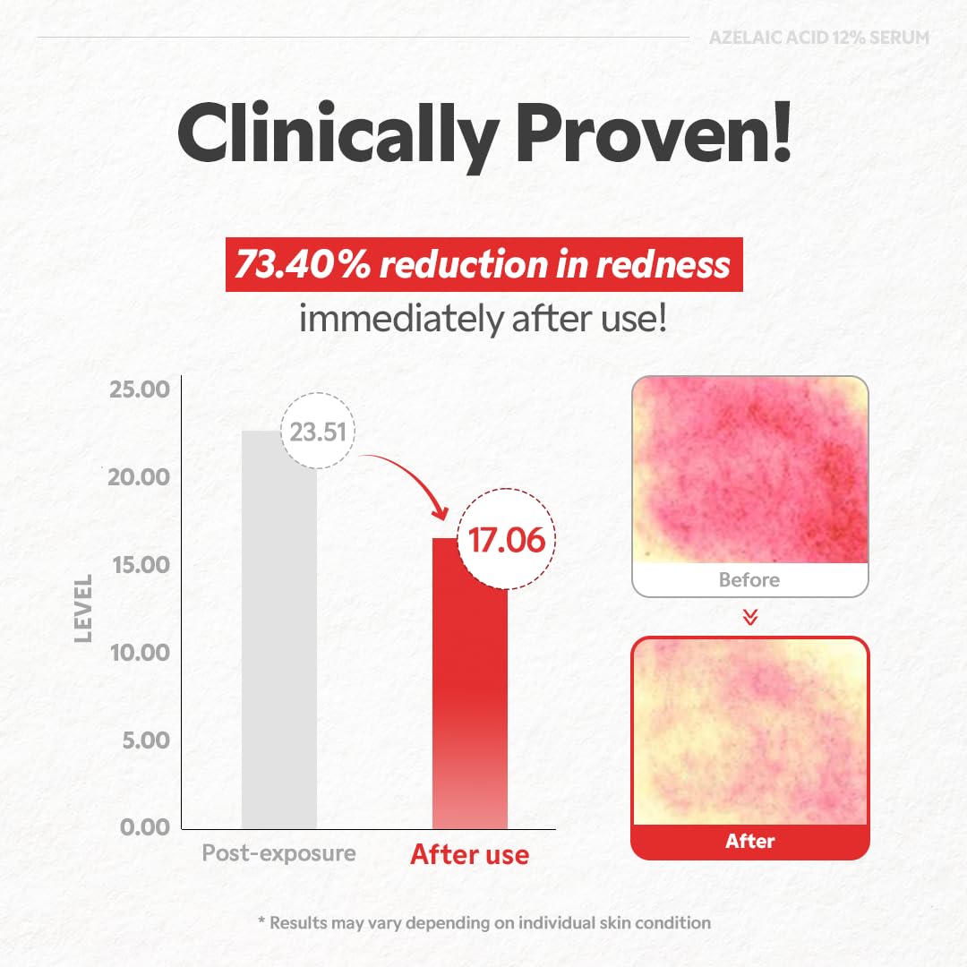 TIRTIR Sunscreen and Azelaic Acid Serum - Sun Care Duo, SPF 50+ UVA/UVB Protection, Lightweight, No White Cast, Non-greasy, Korean Sunscreen, Soothing, Balancing, Gentle Exfoliation